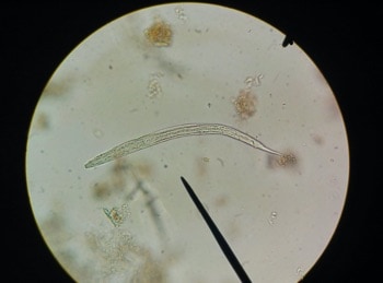 pasożyty pod mikroskopem